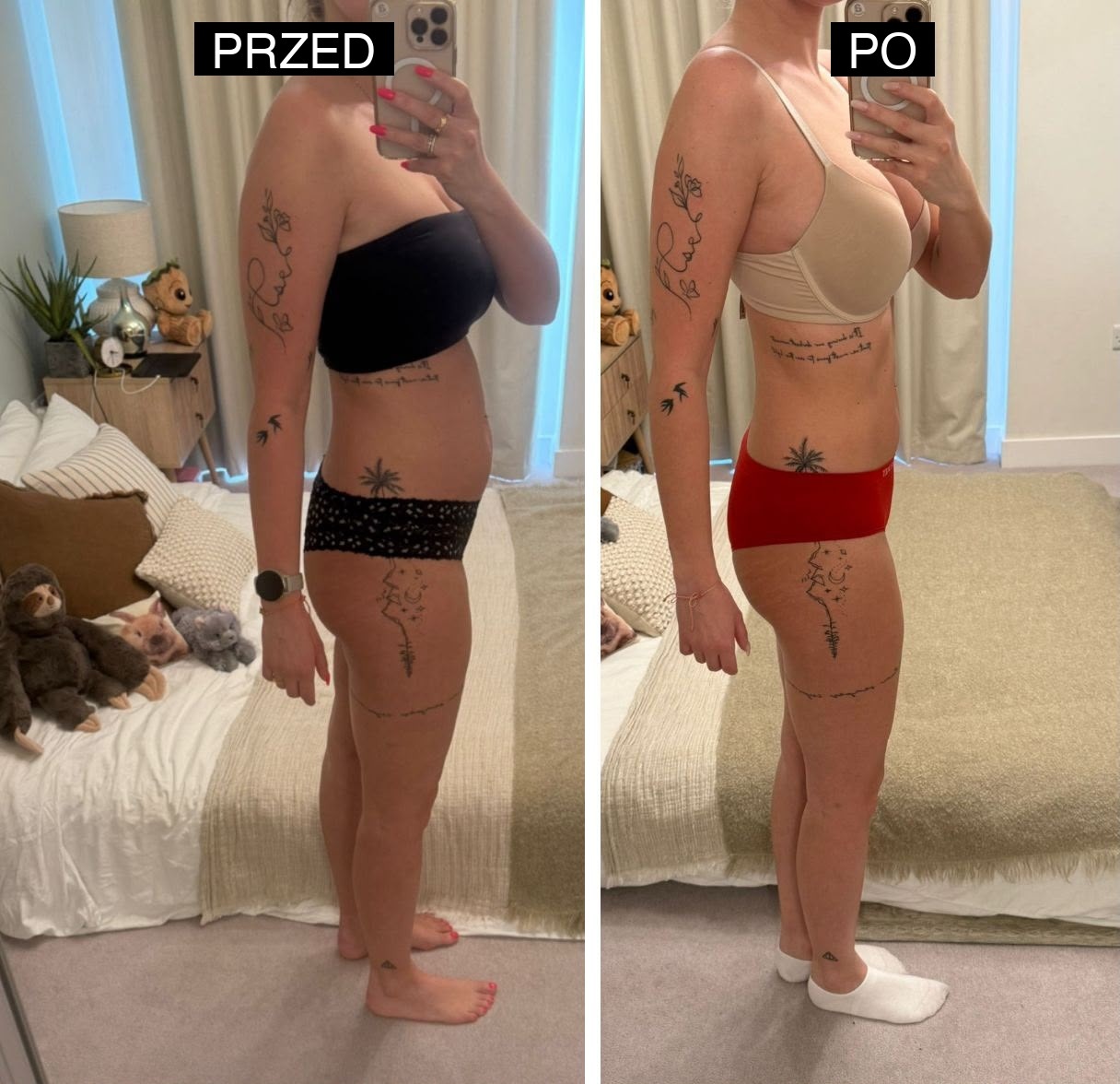 Transformacja przed i po 14 dniach — uczestniczka 1
